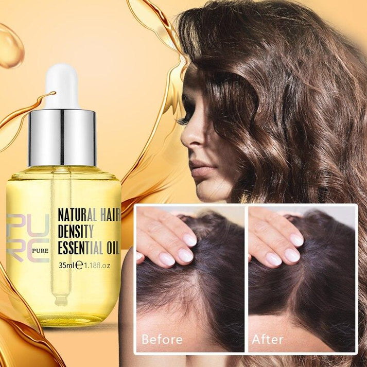 Hair Growth Oil (70% OFF TODAY ONLY!)