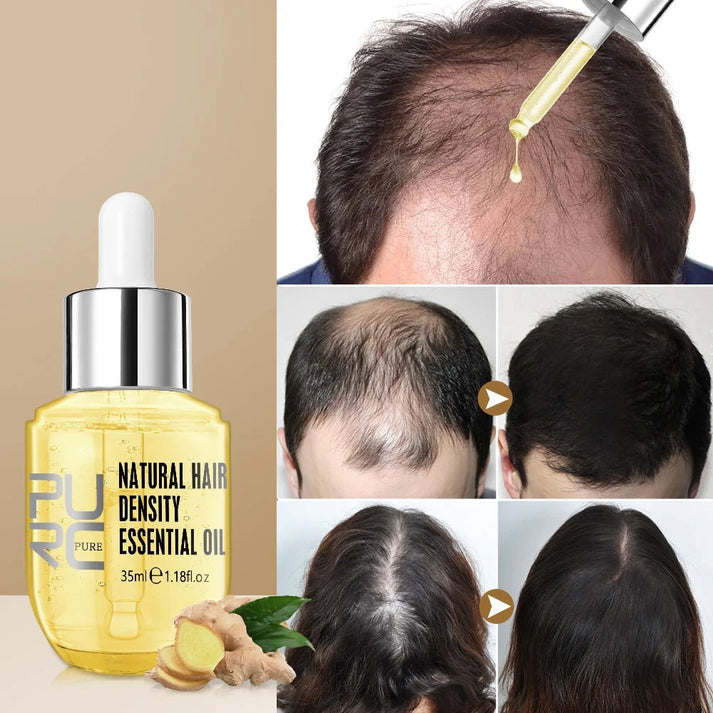 Hair Growth Oil (70% OFF TODAY ONLY!)